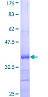 12.5% SDS-PAGE Stained with Coomassie Blue.